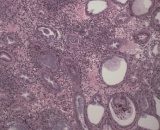 Hội chứng phân trắng trên tôm: Dự báo mầm bệnh vi bào tử trùng EHP?